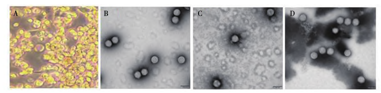 图４ HEK293细胞病变和氯化铯梯度纯化后重组腺病毒的电镜图-卡梅德生物.png